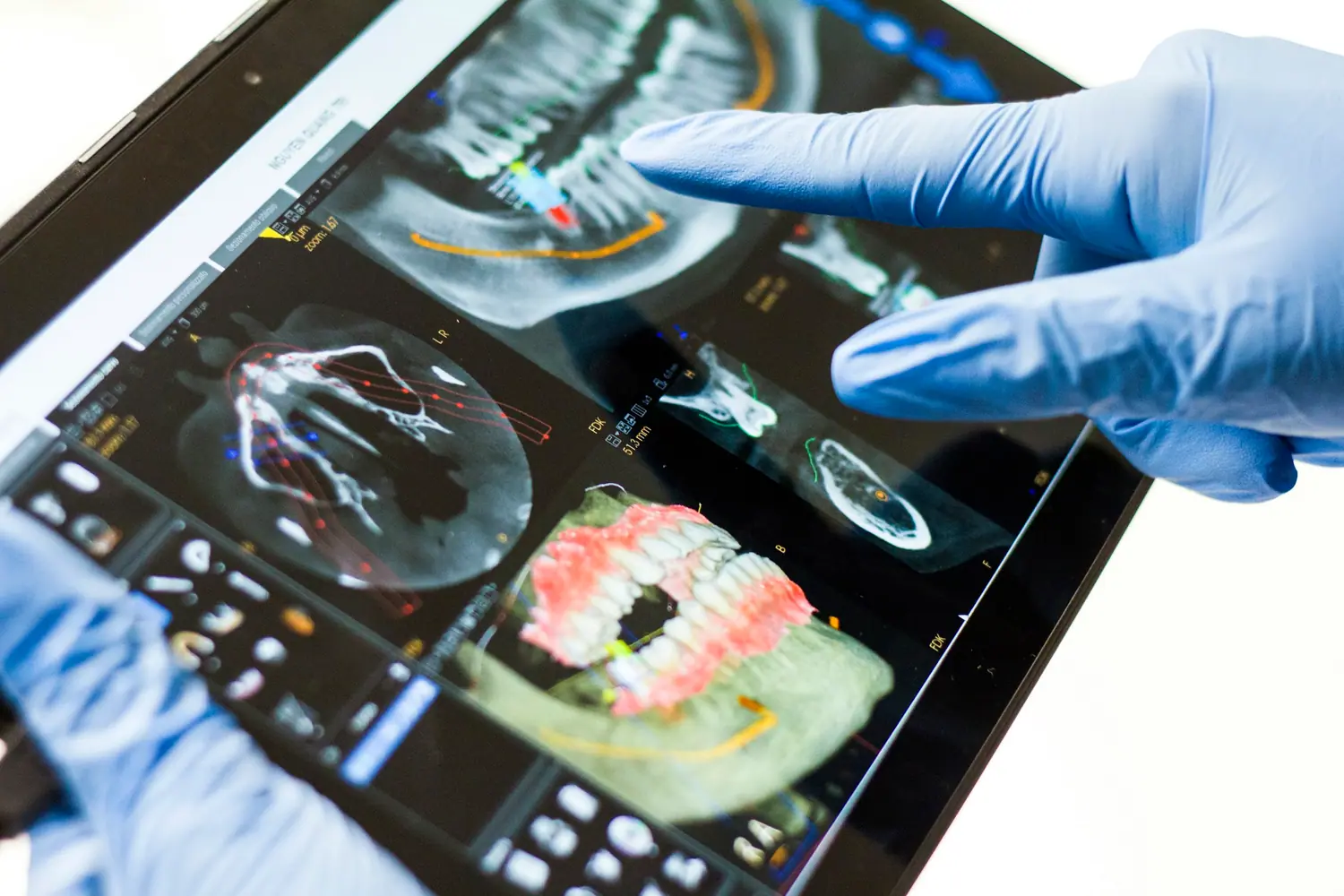 Behandschuhte Hand zeigt auf digitale Aufnahmen auf einem Tablet